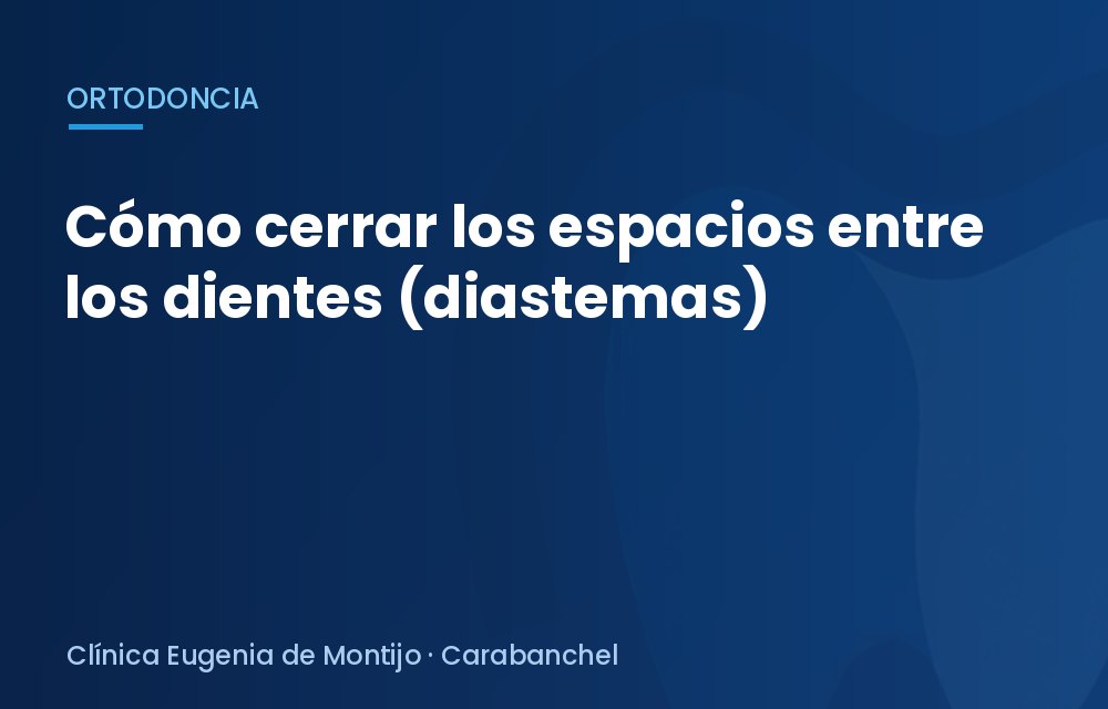 Cómo cerrar los espacios entre los dientes (diastemas)