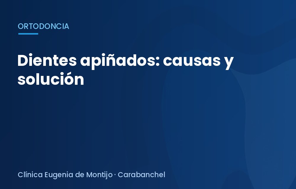 Dientes apiñados: causas y solución