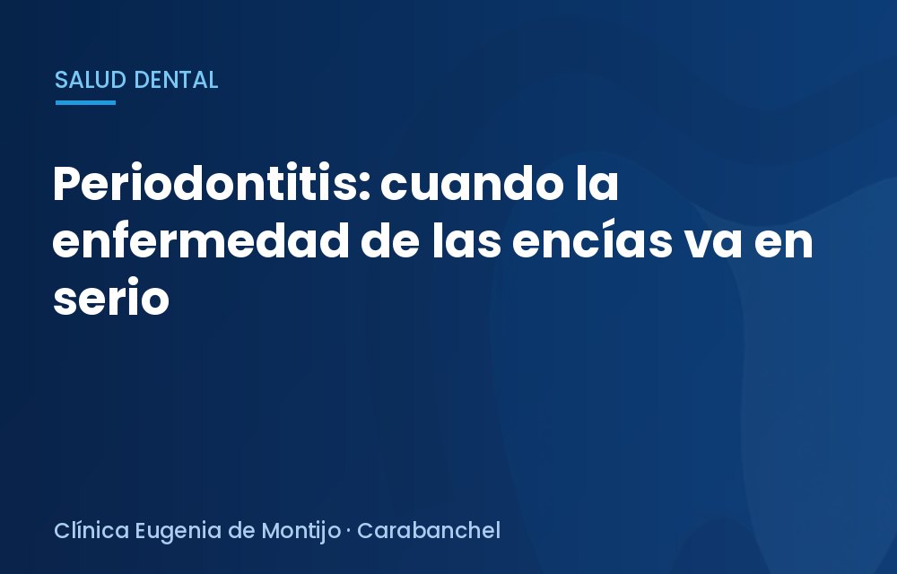 Periodontitis: cuando la enfermedad de las encías va en serio