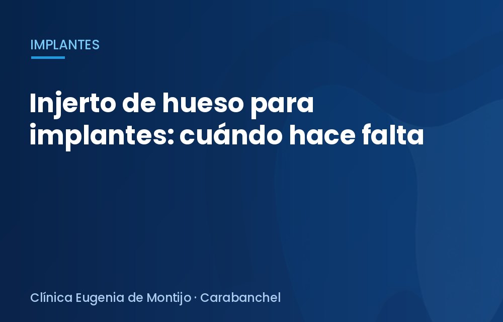 Injerto de hueso para implantes: cuándo hace falta