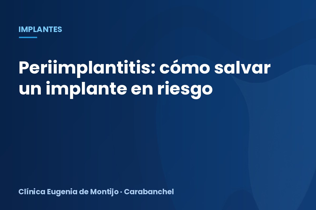 Periimplantitis: señales de alerta y cómo salvar el implante